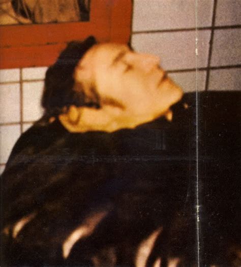 john lennon autopsy photos.